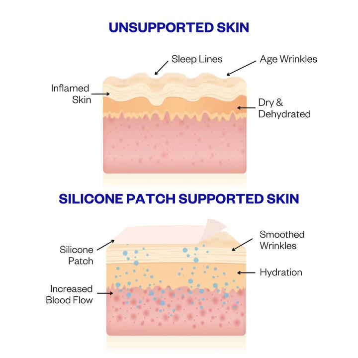 Mouth & Lip Wrinkle Patches